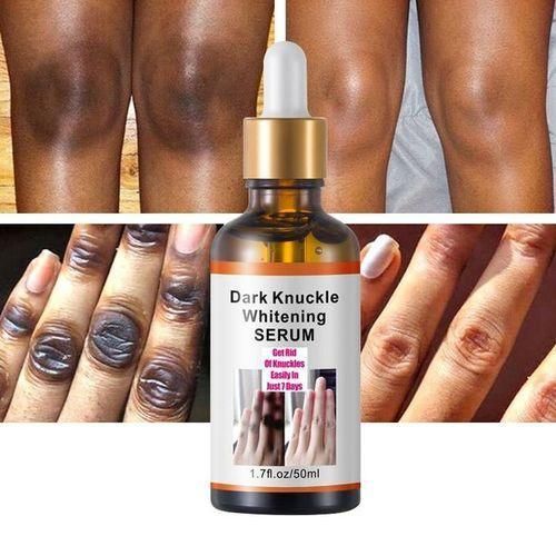 DARK KNUCKLES SERUM Beauty Fast Effective Knuckles And Dark Spot Removal Cream Repair Balm, Balm for Rough Heels, For Dry Skin & Cracked Feet Hydration
