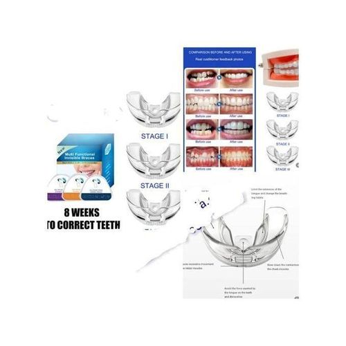 3 STAGE ADULT RETAINER CORRECTOR BRACE TEETH