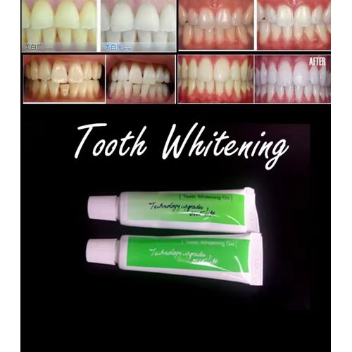Teeth Polish Gel