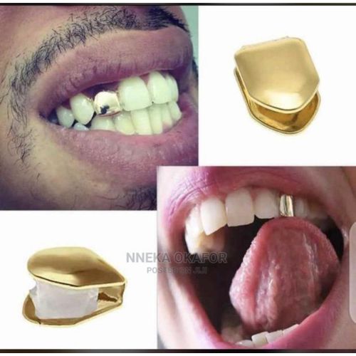 Gold tooth grill