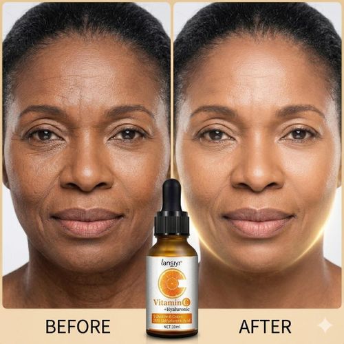 Vitamin C Hyaluronic Acid Face Serum 30ml Anti Aging, Hydrating & Skin Brightening Serum for Hyperpigmentation, Fine Lines & Acne Marks Advanced Vitamin C 20% Serum with Hyaluronic Acid Anti Aging, Dark Spot Remover & Radiant Glow Face Serum for All Skin