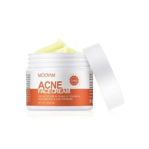 Acne Face Cream
