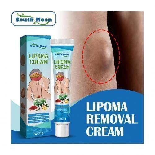 SOUTH MOON Fast Effective Lipoma Removal Cream