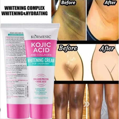 Kojic Acids & Collagen Whiten Collagen Cream - Skin Lightening Underarm Body Lotion Skincare Body Lotion Skin Lightening Anti-Aging Smoothing Anti-Wrinkle Body Care Anti-aging Effective Skin Lightening - Underarm Whiten-ing Cream Dark Spot Corrector
