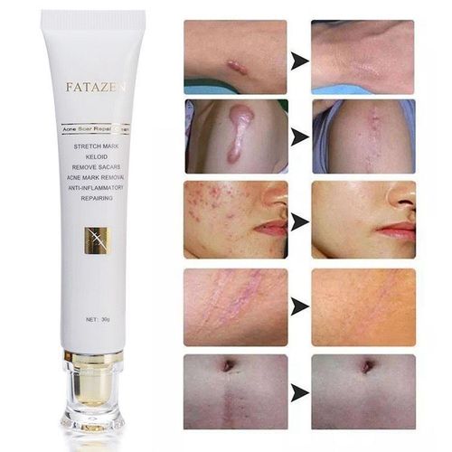 Multipurpose Stretch Mark Removal Cream, Remove Scars, Acne Marks Removal, Anti-Inflammatory Cream - Skin Stretch Repair Stretch Mark Removal Cream- Scar Remover Cream - Remove Pregnancy Scars, Acne Cream Stretch Marks Treatment