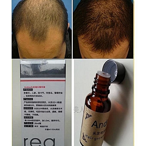 Fastest Hairbeard Growing Cream 20ml 5 Packs Unisex