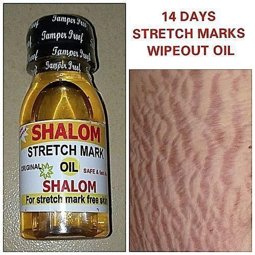 Stretch Marks Removal Oil 2pc