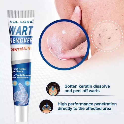 SOL LORA PROFESSIONAL Skin Tag Wart Removal Cream with Herbal Extracts – Gentle Skin Tag Remover for Body & Foot – Advanced Treatment for Warts, Corns, and Moles – Moisturizing Repair Formula for Smooth, Clear, Healthy Skin