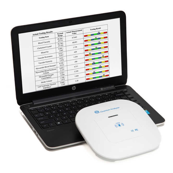 Quantum analysator with newest 2023 software