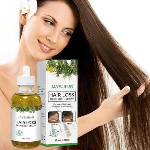 HAIR LOSS TREATMENT SERUM Hair Care Essential Oil, Ginger Hair Serum, Healthy Hair Penetrates Root To Tip-Restoration Ginger Germinal Oil