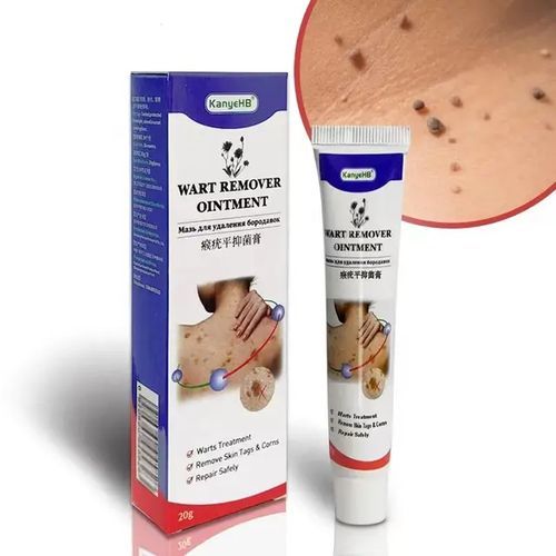 Fast Acting Herbal Wart Removal Ointment Cream
