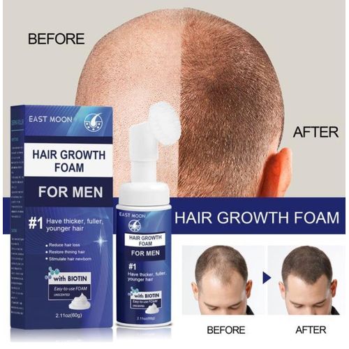 Kirkland Minoxidil 5% Minoxidil With Biotin Hair Growth Treatment, Can Foam Aerosol