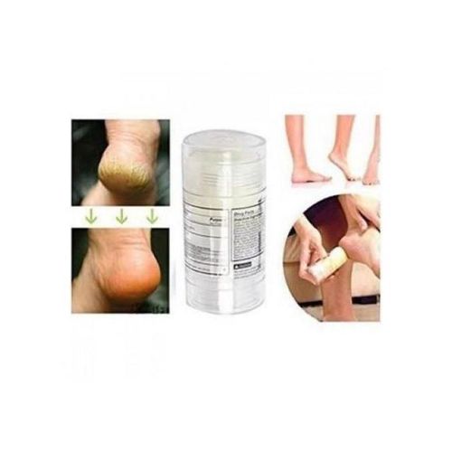 Cracked Hands & Feets Intensive Repair Therapy