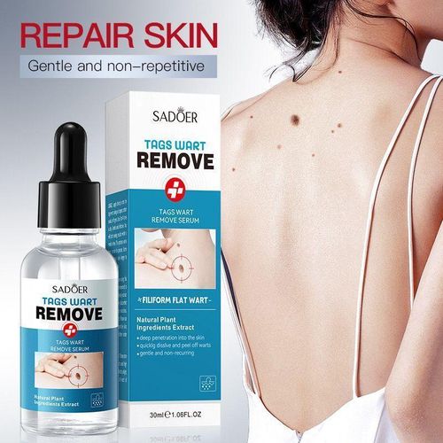 Quick Wart & Skin Tag Remover Serum Fast-Acting Wart and Skin Tag Removal Solution for Hands, Feet, and Body