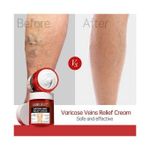 product_image_name-Auquest-Varicose Veins Relief Cream 80g-1