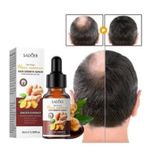 product_image_name-SADOER-Ginger Hair Growth Serum-2