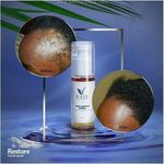 product_image_name-Fashion-Hair Growth Serum-3