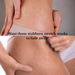 product_image_name-Generic-BEAUTY ROUTINE OFFICIAL DERMAFIX TRETINON CREAM STRETCH MARKS -2