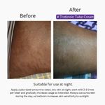 product_image_name-Generic-BEAUTY ROUTINE OFFICIAL DERMAFIX TRETINON CREAM STRETCH MARKS -5