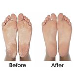 product_image_name-Pedi Pro-Foot Pedicure Roller Feet Dead Skin Remover -3