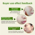 product_image_name-Generic-Face Exfoliating Cleanser Blackhead Acne Removing Cleanser-4