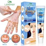Herbal Extract Vitiligo Removal Onitiment Treatments
