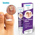 product_image_name-Sumifun-Nail Fungus, Anti-bacterial, Cream For Foot And Fingernails Care-1