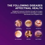 product_image_name-Sumifun-Nail Fungus, Anti-bacterial, Cream For Foot And Fingernails Care-5