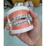 product_image_name-Generic-Miami Unisex Teeth Braces _Fashion/Dental Care Tool -1