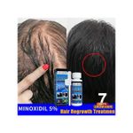product_image_name-Minoxidil-East Moon 5% Hair & Beard Growth Hair Increase Oil - Hair Treatment-4