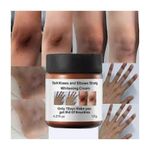 MOOYAM Dark Knees Elbows And Knuckles Strong Whitenin Cream
