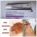 Permethrin Cream For Scabies And Rashes