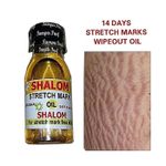 Shalom 14 Days Effective Stretch Marks Oil