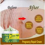 product_image_name-Generic-7 Days Super Strong Stretch Mark Removal Cream-3