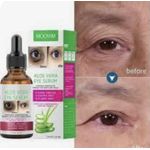 product_image_name-Generic-ALOE VERA EYE SERUM-1