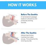 product_image_name-Generic-Anti-snoring mouthguard, reusable, discreet and comfortable.-8