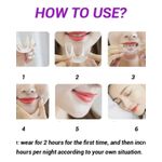Generic Complete Three (3) Stages Orthodontic Teeth Alignment Braces / Retainer/ Trainer - image 2