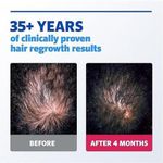 product_image_name-Generic-Rogaine Men's Extra Strength 5% Minoxidil Topical Solution For Hair Loss And Regrowth, 3 Month Supply-4