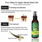 product_image_name-Generic-Ginger Germinal Oil For Hair Growth - King Of Ginger 7 Days Hair Spray - 7 Days Restoration For Bald Head Hair - Ginger Germinal Oil-4