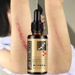 product_image_name-Lavender-Scar, Stretch Marks And Acne Removal Oil - Fast Action-2