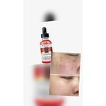 product_image_name-Roushun-RED POMEGRANATE SERUM-5