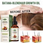product_image_name-MEJISOO-Organic Batana Rosemary Oil for Hair Growth & Anti-Hair Loss, Natural DHT Blocker Scalp Treatment for Thinning Hair, Nourishing Dry Scalp & Strengthening Follicles Cold-Pressed, Non-Greasy, Improves Scalp Circulation, Strengthens the Hair Cuticle-2