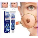 product_image_name-Eelhoe-Wart Remover Ointment Removes Skin Tags & Corns Remover Cream Wart Remover Ointment Maximum Strength - Wart Gel Cream With Salicylic Acid - Fast-Acting Cream Wart Freeze Off - Wart Cream For Genital Warts, Plantar Wart, Common Wart, Corn, Flat Wart 20g-5