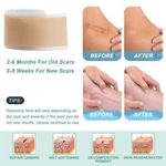 product_image_name-Scar-EFFECTIVE Silicone sheets for scars, suitable for surgical recovery, keloids, burns, cesarean section and wound protection-2