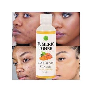Tumeric Face Toner - Dark Spots Eraser And Acne Removal
