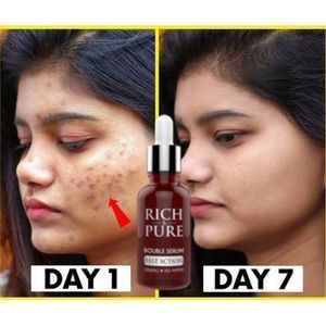 Rich & Pure Double Serum For Acne, Dark Spots & Sunburn Removal 30ml