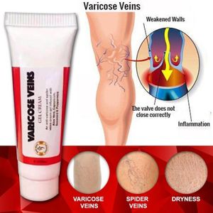 Varicose Veins Gel Cream