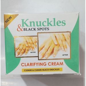 Skin Beauty Knuckles & Black Spots Remover- Very Effective