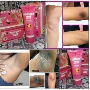 Aichun-Beauty Magic White Yogurt Milk Underarm Dark Spot Cream (80g