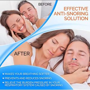 2pcs Blue Anti Snoring Magnetic, Anti Snoring Device For Men & Women Mini Portable Easy To Take Soft Ventilation Nose Clip...